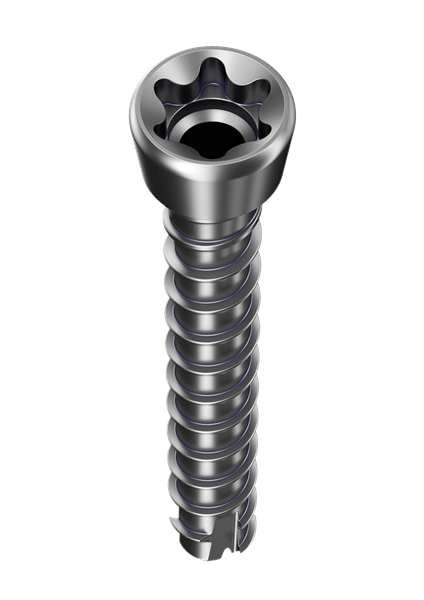 High Performance im Innensechsrund